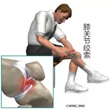 《输游戏必看！十大“膝盖中箭”借口大盘点》