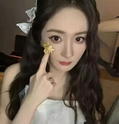 杨幂滑雪发现右臂抬起困难,检查得知部分钙化,这咋跟打游戏卡壳似的?